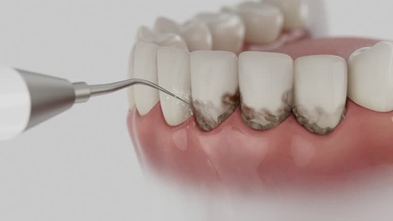 Trusted Teeth Cleaning And Checkup service in Kitty Hawk, NC - Dentist Open Now